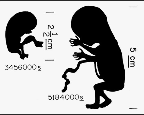 Fetus diagram